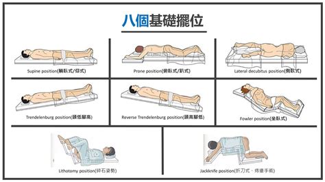 截刀臥位姿勢|痔瘡的治療原則與方法